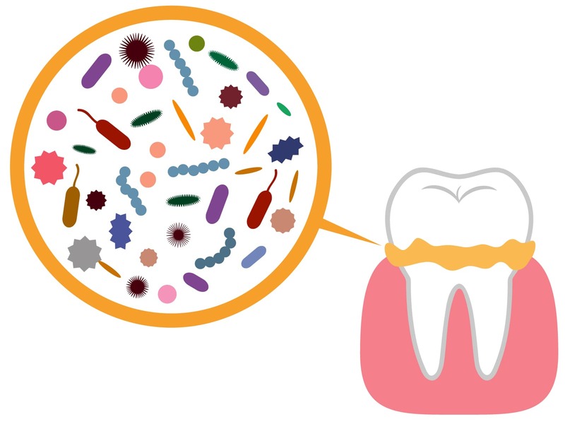 歯周病って口臭にも関係あるの？ 